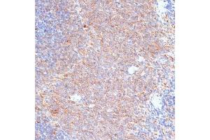 Immunohistochemistry of paraffin-embedded rat spleen using G3BP1 antibody (ABIN7267528) at dilution of 1:100 (40x lens). (G3BP1 antibody  (AA 131-330))