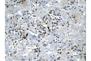 Image no. 1 for anti-Stearoyl-CoA Desaturase (Delta-9-Desaturase) (SCD) (AA 190-239) antibody (ABIN202340) (SCD antibody  (AA 190-239))