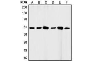 Western blot analysis of CD95 expression in HeLa (A), A431 (B), K562 (C), HL60 (D), mouse brain (E), H9C2 (F) whole cell lysates.