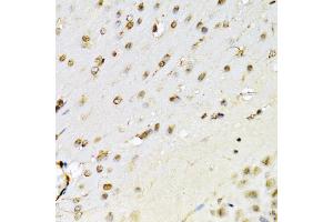 Immunohistochemistry of paraffin-embedded mouse brain using RUNX1 Antibody (ABIN3022803, ABIN3022804, ABIN3022805 and ABIN6219236) at dilution of 1:100 (40x lens). (RUNX1 antibody  (AA 150-250))