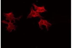 ABIN6266611 staining A549 by IF/ICC. (Dynamitin antibody  (C-Term))