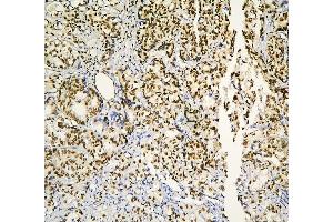 IHC analysis of PHF21A using anti-PHF21A antibody (ABIN6719353). (PHF21A antibody  (AA 1-97))