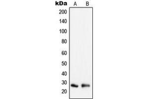 Western blot analysis of Peroxiredoxin 3 expression in HeLa (A), MCF7 (B) whole cell lysates. (Peroxiredoxin 3 antibody  (Center))