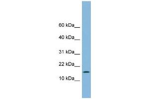 WB Suggested Anti-UBE2L6 Antibody Titration: 0. (UBE2L6 antibody  (Middle Region))