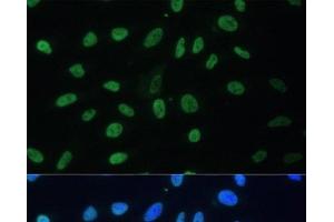 Immunofluorescence analysis of U-2 OS cells using HNRNPD Polyclonal Antibody at dilution of 1:100. (HNRNPD/AUF1 antibody)
