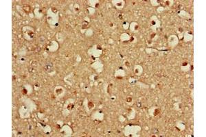 Immunohistochemistry of paraffin-embedded human brain tissue using ABIN7152131 at dilution of 1:100 (EIF2S1 antibody  (AA 276-315))