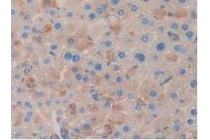 IHC-P analysis of Mouse Liver Tissue, with DAB staining. (Clusterin antibody  (AA 227-447))