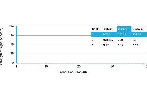 Protein Array (PAr) image for anti-Parvalbumin (PVALB) antibody (ABIN7455989) (PVALB antibody)
