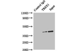 Immunoprecipitating TREX1 in Hela whole cell lysate Lane 1: Rabbit control IgG instead of (1 μg) instead of ABIN7172071 in Hela whole cell lysate. (TREX1 antibody  (AA 1-270))
