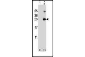 Western blot analysis of RNF11 (arrow) using RNF11 Antibody (Center) Cat.