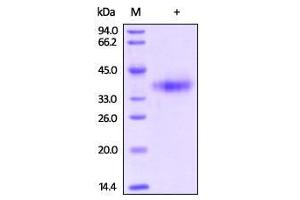 SDS-PAGE (SDS) image for Mesothelin (MSLN) (AA 296-580) (Active) protein (His tag,Biotin) (ABIN2444164)