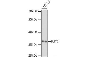 Western blot analysis of extracts of HT-29 cells using FUT2 Polyclonal Antibody at dilution of 1:1000. (FUT2 antibody)