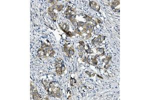 IHC analysis of CTNNA1 using anti-CTNNA1 antibody (ABIN7600057). (CTNNA1 antibody  (AA 143-292))
