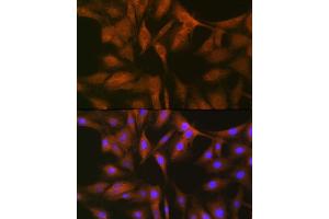 Immunofluorescence analysis of C6 cells using FXR1 Rabbit mAb (ABIN7267257) at dilution of 1:100 (40x lens). (FXR1 antibody)