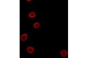ABIN6274098 staining 293 by IF/ICC. (GSC2 antibody  (Internal Region))