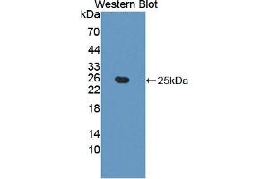 Western blot analysis of the recombinant protein. (Ephrin A5 antibody  (AA 21-203))