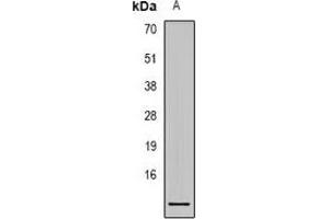 Western blot analysis of S100-A1 expression in Hela (A) whole cell lysates. (S100A1 antibody)