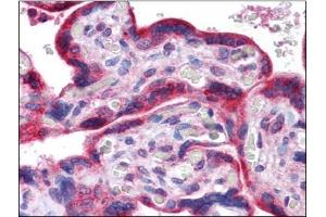 Human Placenta: Formalin-Fixed, Paraffin-Embedded (FFPE) (PLK1 antibody)