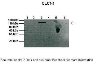 Lanes:   1: 20ug mouse muscle membrane fraction, 2: Empty, 3: 20ug mouse brain membrane fraction, 4: Empty, 5: 20ug mouse muscle cytosolic fraction, 6: 20ug mouse brain cytosolic fraction  Primary Antibody Dilution:   1:1000  Secondary Antibody:   Anti-rabbit HRP  Secondary Antibody Dilution:   1:2000  Gene Name:   Clcn1  Submitted by:   Anonymous (CLCN1 antibody  (C-Term))