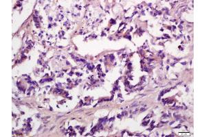 Immunohistochemistry (IHC) image for anti-Eukaryotic Translation Initiation Factor 4E (EIF4E) (AA 121-217) antibody (ABIN1386772)