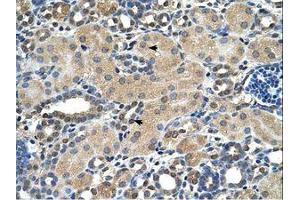 Image no. 1 for anti-Aspartate beta-Hydroxylase (ASPH) (AA 66-115) antibody (ABIN321861) (Aspartate beta Hydroxylase antibody  (AA 66-115))