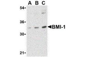 Western Blotting (WB) image for anti-BMI1 Polycomb Ring Finger Oncogene (BMI1) (Center) antibody (ABIN2477677) (BMI1 antibody  (Center))