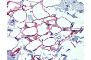 Immunohistochemistry (IHC) image for anti-Nuclear Factor I/C (CCAAT-Binding Transcription Factor) (NFIC) (Middle Region) antibody (ABIN406784) (NFIC antibody  (Middle Region))