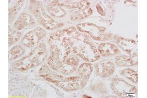 Formalin-fixed and paraffin embedded human kidney labeled with Rabbit Anti-phospho-CREB-1(Ser133) Polyclonal Antibody (ABIN723980) at 1:200 followed by conjugation to the secondary antibody and DAB staining. (CREB1 antibody  (pSer133))