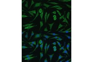 Immunofluorescence analysis of L929 cells using G antibody (ABIN7267529) at dilution of 1:100. (GAPVD1 antibody  (AA 1-260))