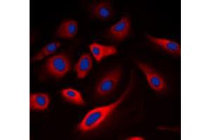 Immunofluorescent analysis of Calmodulin (pT80/S82) staining in A549 cells. (Calmodulin 1 antibody  (pSer80, pSer82))