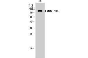 Western Blotting (WB) image for anti-Signal Transducer and Activator of Transcription 3 (Acute-Phase Response Factor) (STAT3) (pTyr705) antibody (ABIN3182150) (STAT3 antibody  (pTyr705))