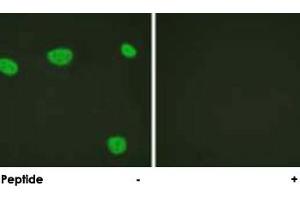 Immunofluorescence analysis of HeLa cells, using VDR polyclonal antibody .