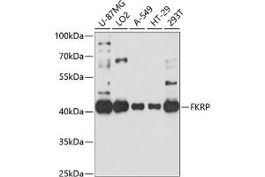 Western blot analysis of extracts of various cell lines, using FKRP antibody (ABIN6132005, ABIN6140666, ABIN6140667 and ABIN6214350) at 1:1000 dilution. (FKRP antibody  (AA 30-220))