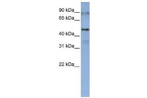 WB Suggested Anti-DAZAP1  Antibody Titration: 0. (DAZAP1 antibody  (Middle Region))