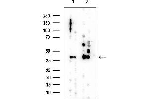 Western blot analysis of lysates from various samples, using Nucleophosmin Mouse Monoclonal Antibody at 1/1000 dilution.