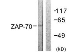 Western blot analysis of extracts from 293 cells, treated with PMA 125ng/ml 30', using ZAP-70 (Ab-292) Antibody. (ZAP70 antibody  (AA 258-307))