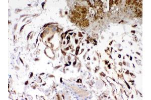 Immunohistochemistry (IHC) image for anti-Insulin-Like Growth Factor Binding Protein 1 (IGFBPI) (AA 69-259) antibody (ABIN5518851)