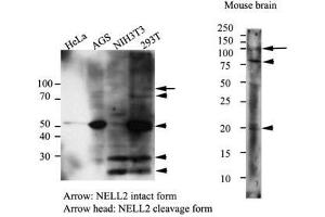 The cell lysates (40 ug) were resolved by SDS-PAGE, transferred to PVDF membrane and probed with anti-human NELL2 (1:500). (NELL2 antibody  (AA 30-258))