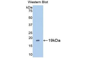 Western blot analysis of the recombinant protein. (Caspase 2 antibody  (AA 170-333))