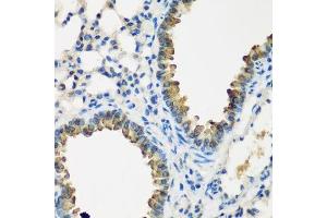 Immunohistochemistry of paraffin-embedded mouse lung using CYP2F1 antibody. (CYP2F1 antibody  (AA 100-290))