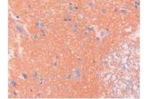 IHC-P analysis of Rat Spinal Cord Tissue, with DAB staining. (SPTAN1 antibody  (AA 2071-2269))