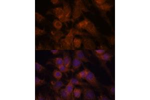 Immunofluorescence analysis of C6 cells using SEC23IP antibody (ABIN7270170) at dilution of 1:100. (SEC23IP antibody  (AA 600-940))