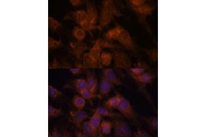 Immunofluorescence analysis of C6 cells using SEC23IP antibody (ABIN7270170) at dilution of 1:100.