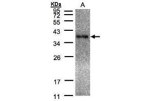 WB Image Sample(30 μg of whole cell lysate) A:Raji, 12% SDS PAGE antibody diluted at 1:5000 (EPM2A antibody  (C-Term))