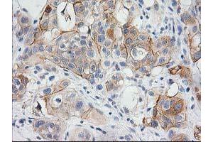 Image no. 2 for anti-BAI1-Associated Protein 2 (BAIAP2) antibody (ABIN1496805) (BAIAP2 antibody)