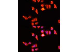Immunofluorescence analysis of HeLa cells using HOX antibody (ABIN3017106, ABIN3017107, ABIN1680330 and ABIN6219956) at dilution of 1:100 (40x lens).