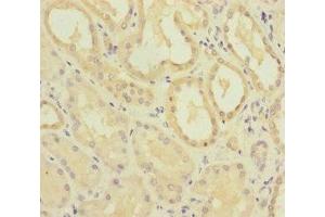 Immunohistochemistry of paraffin-embedded human kidney tissue using ABIN7159655 at dilution of 1:100 (MMACHC antibody  (AA 63-282))