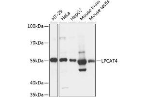 Western blot analysis of extracts of various cell lines, using LPC antibody (ABIN7268338) at 1:3000 dilution. (LPCAT4 antibody  (AA 345-524))