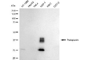 Western blotting analysis using Podoplanin antibody (ABIN7799861).