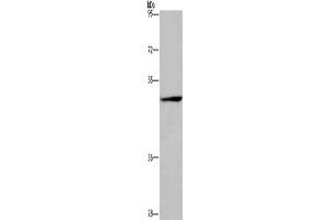 Gel: 6 % SDS-PAGE, Lysate: 50 μg, Lane: Jurkat cells, Primary antibody: ABIN7131059(SIGLEC9 Antibody) at dilution 1/350, Secondary antibody: Goat anti rabbit IgG at 1/8000 dilution, Exposure time: 30 seconds (SIGLEC9 antibody)